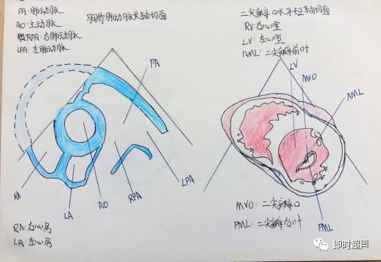 胸骨旁左心室长轴切面 二 胸骨旁主动脉根部短轴切面 三 胸骨旁肺