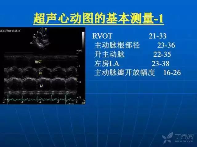 精彩幻灯:超声心动图标准切面及正常值