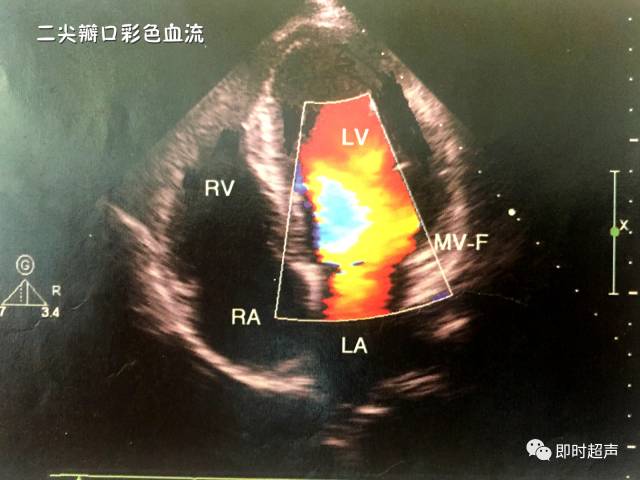 这些心脏彩超图大写的牛