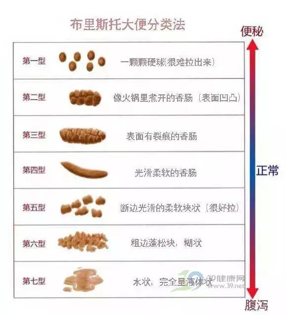 医学上有一种布里斯托大便分类法↓