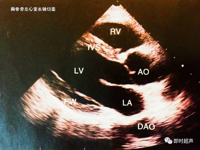 这些心脏彩超图,大写的牛!