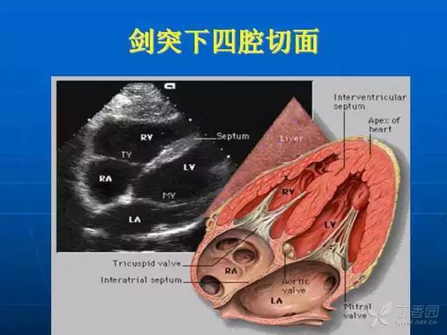 精彩幻灯:超声心动图标准切面及正常值