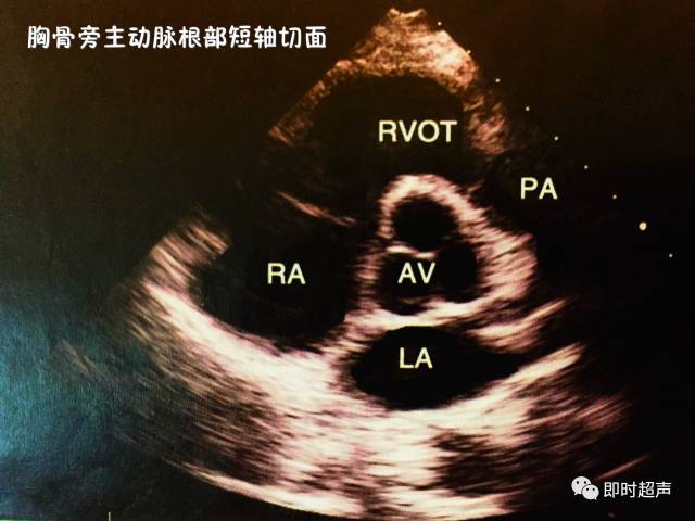 这些心脏彩超图大写的牛