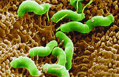 怎样治疗幽门螺杆菌感染?