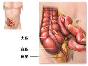 阑尾炎早期在右下腹压痛出现前易被误诊为急性胃肠炎,而在阑尾炎穿孔