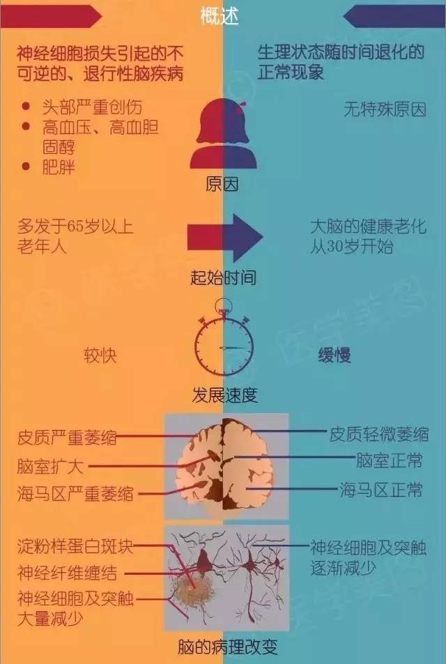 医学美图 | 3分钟轻松识别"阿尔茨海默病"(老年痴呆与