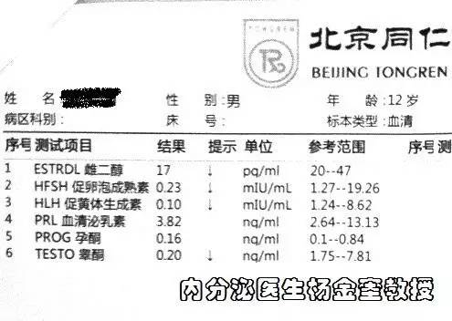 b超,双侧睾丸小.图片中,核磁报告,双侧嗅球非常小.