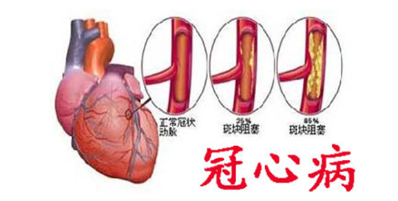 冠心病是什么原因引起的