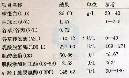 独家胰腺炎还是胰腺癌五专家联合会诊说明白