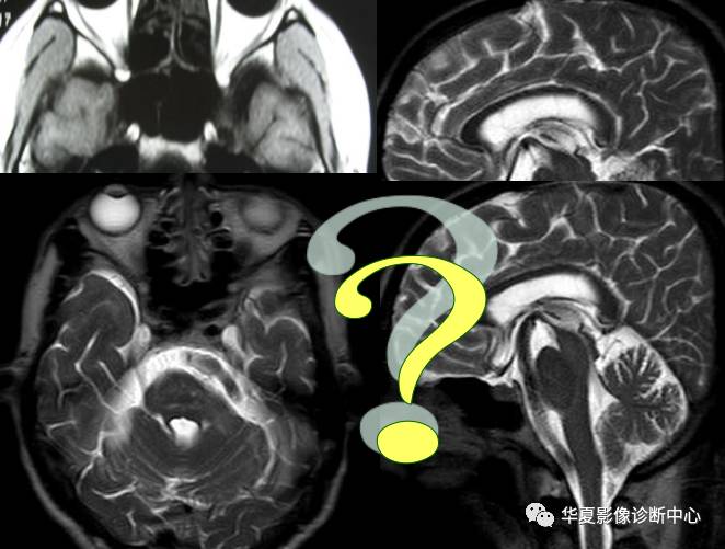 必看9个连磁共振都可能漏诊或误诊疾病