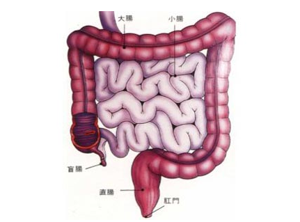 内科主任医师:结肠癌几个明显的征兆,或许你就有