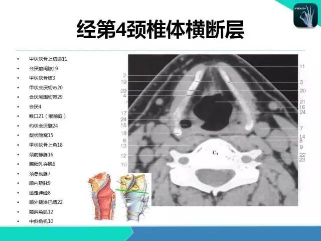 一剑封喉,这解剖学得真是绝了!-搜狐健康