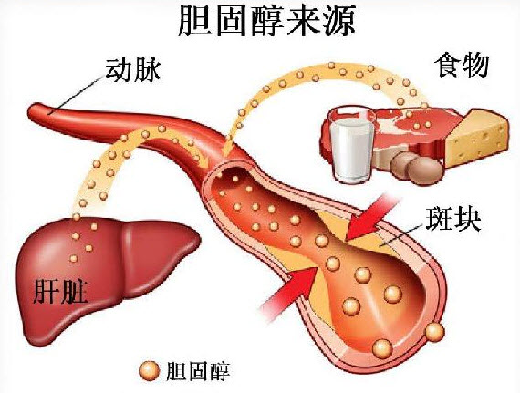 孕期正确看待胆固醇