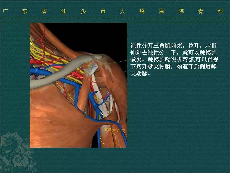 骨哥手术课堂:如何用锚钉治疗肩锁关节脱位