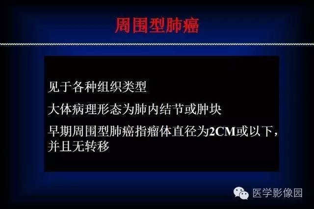 肺癌ct征象及病理基础总结收藏