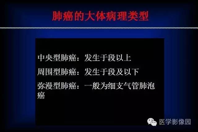 肺癌ct征象及病理基础总结收藏