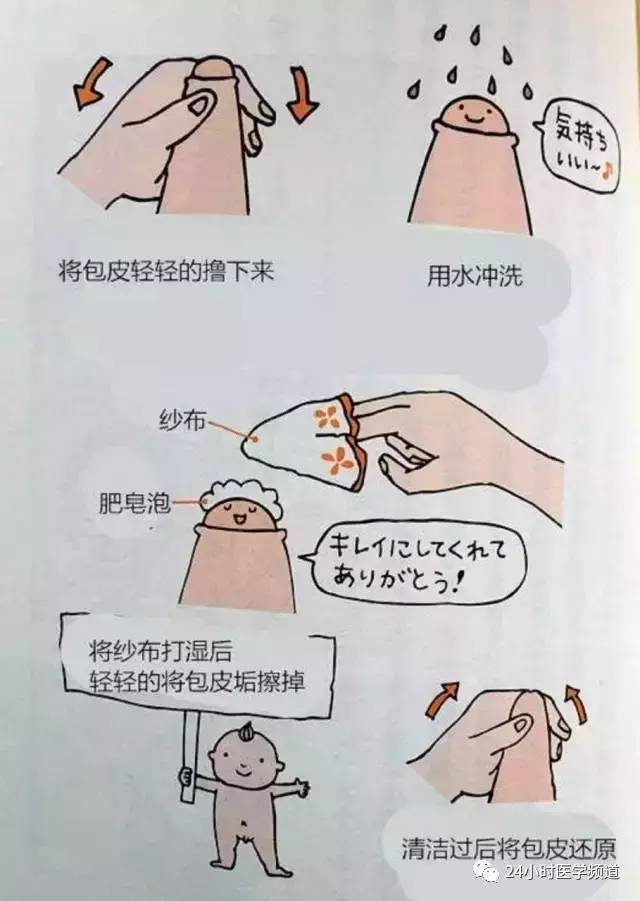 包皮,到底割不割?