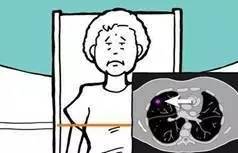 肺小结节是肺癌的征兆么?看完你就清楚了··