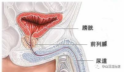 【健康】正确认识前列腺钙化