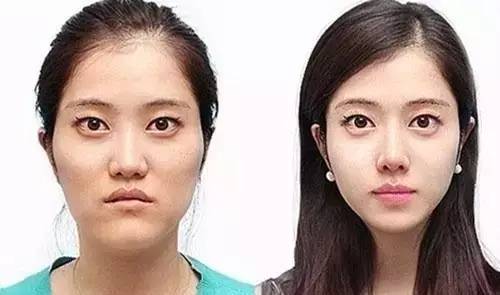 韩国女生整容前vs整容后的区别