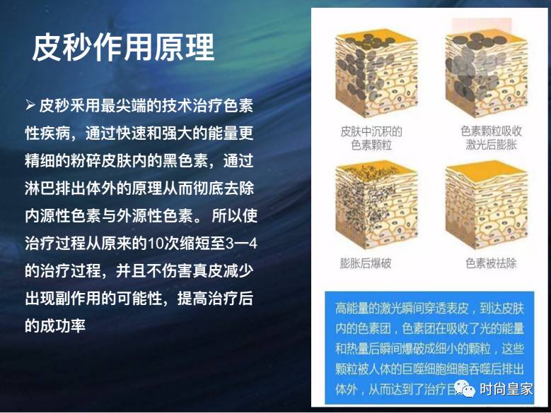 【美丽定制篇】祛斑扫黄——皮秒