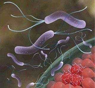 世界上感染率超高的幽门螺杆菌最佳根除方法(
