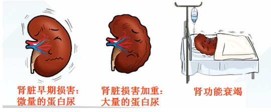 糖尿病肾病那些事儿