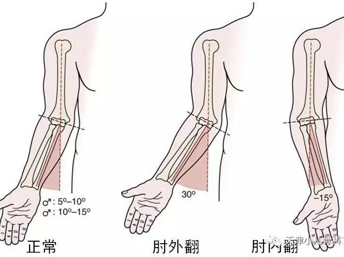 小儿骨科