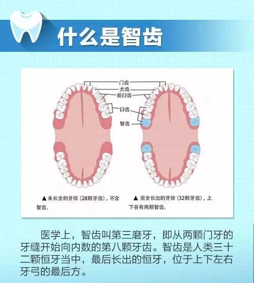 【健康】你的智齿要拔吗?九张图告诉你!