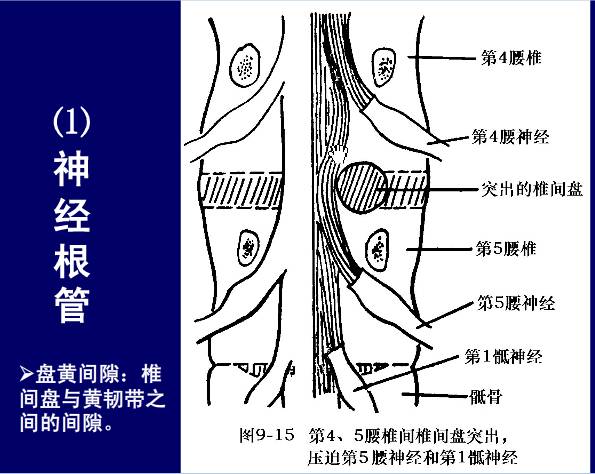 脊柱腰段解剖详解上