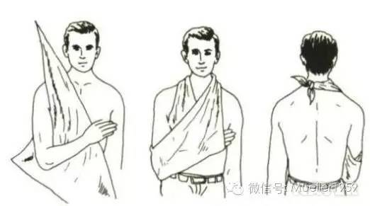 (2)三角巾包扎法:三角巾应用方便,适用于全身各