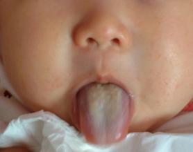 【舌苔发白】宝宝舌苔发白怎么办_宝宝舌苔厚白怎么处理_宝宝舌头上有白苔怎