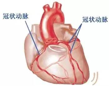 心脏搭脉停博是怎么意思_心脏搭桥是怎么回事(3)