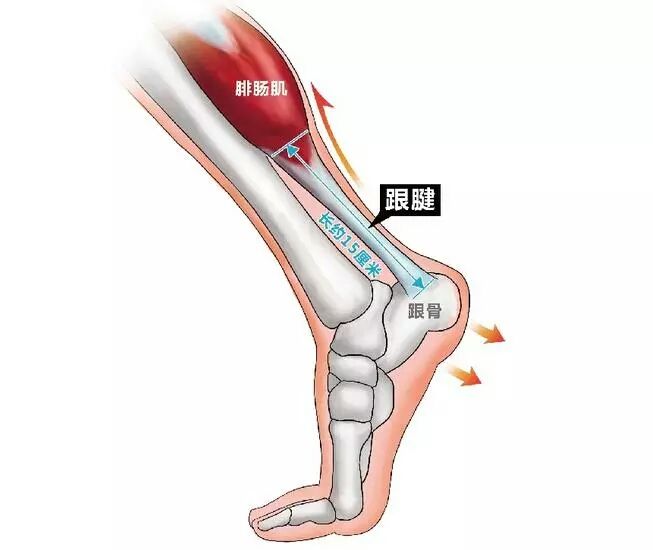 跑步导致跟腱发炎,该如何缓解?