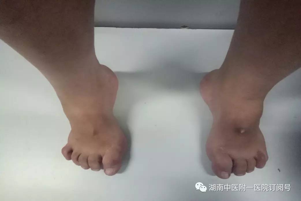 湖南中医附一成立足踝专科专病科室