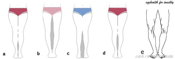 下图为腿型的分类图,光脚直立地面挺胸收腹对镜子或拍照观察