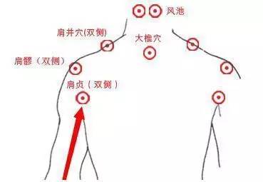 【国医·养生】肩井——治颈项强痛和乳汁不足的奇穴