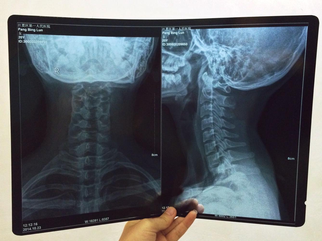 颈椎X线诊断的内容及其解读 - 好医术早读文章 - 好医术-赋能医生守护生命