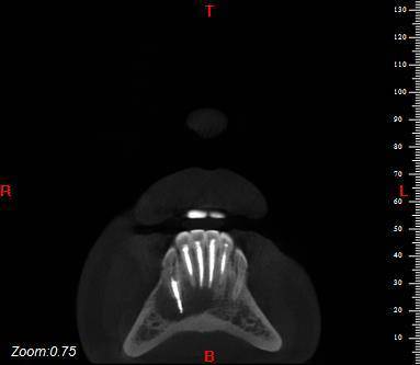 大视野口腔CBCT与三合一口腔CBCT有哪些区
