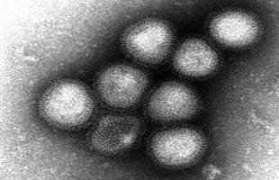 世卫组织:尚无证据证明H7N9病毒可持续人际传