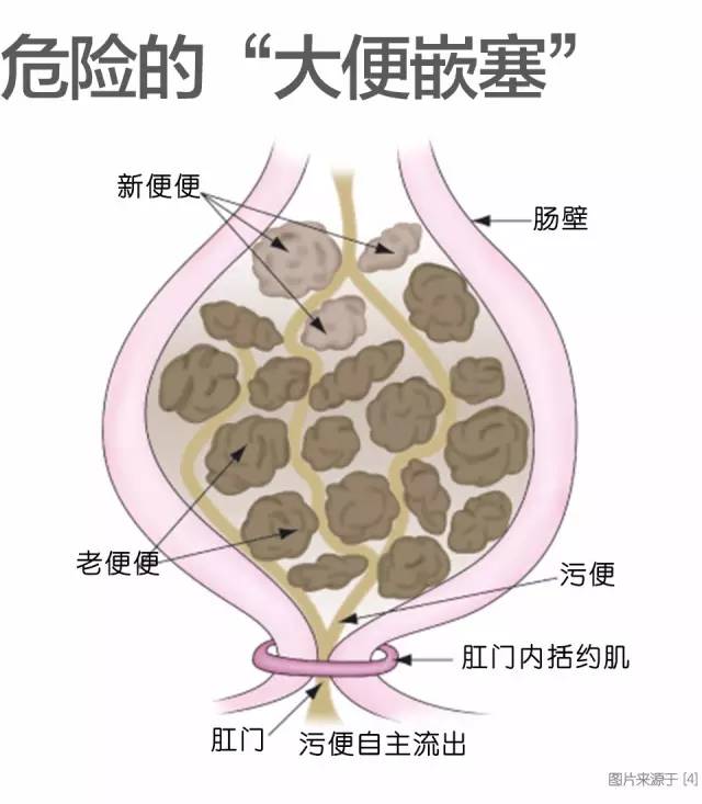 宝宝拉臭臭费劲怎么办