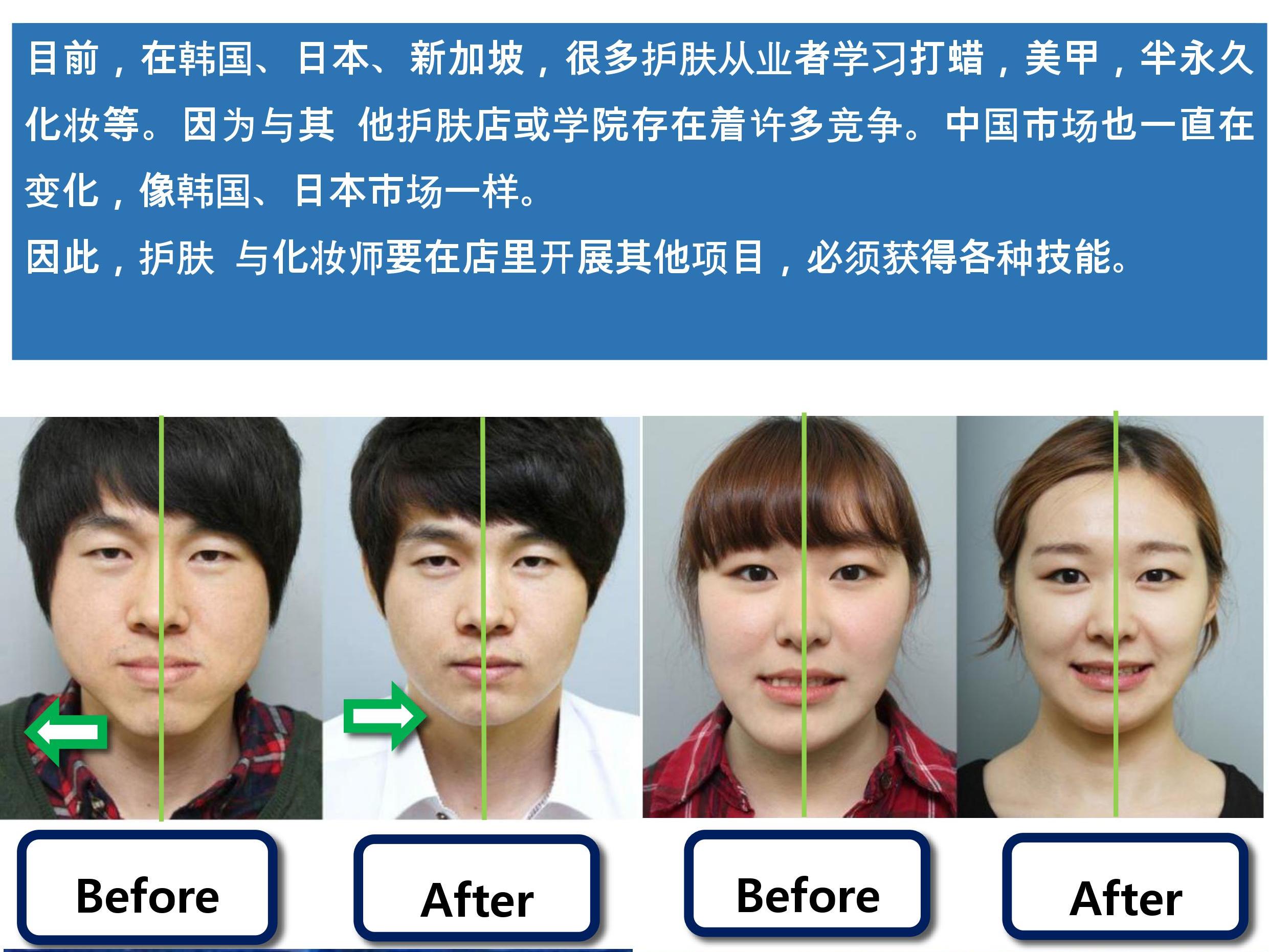网友曝光：去韩国找擅长修复双眼皮的整形医院全过程-非常爱美
