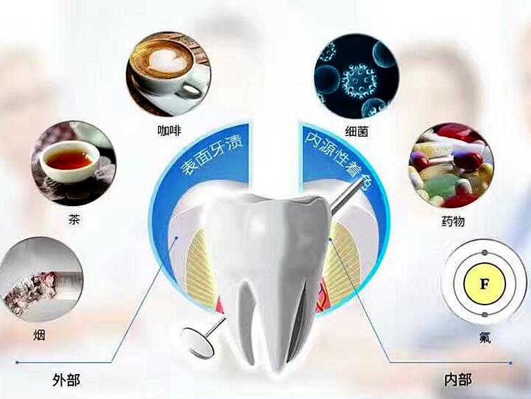 牙齿黄好难看,有什么方法可以让牙齿变白呢?_