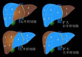 这份肝脏解剖图解,不收藏就亏了!