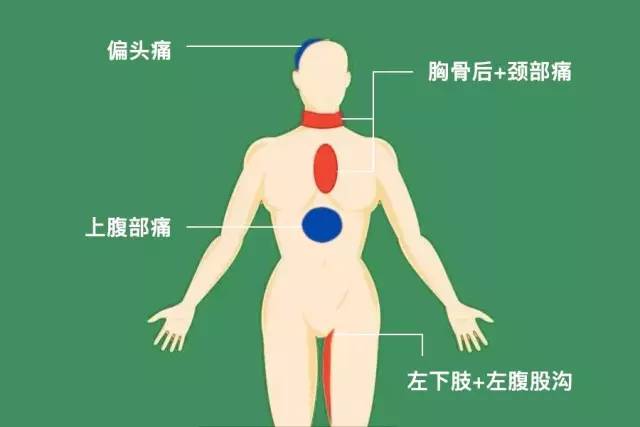 5,胸骨后,颈部痛 是指颈与胸廓下缘(胸部正中或偏侧)之间疼痛:冠心病