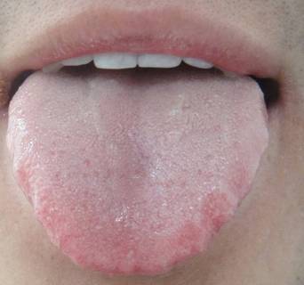 舌诊图谱大全:看看舌头就知道你哪儿病了!你也来学学