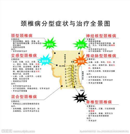 首页 中医养生 > 正文     椎动脉型颈椎病常因颈椎节段性的不稳定