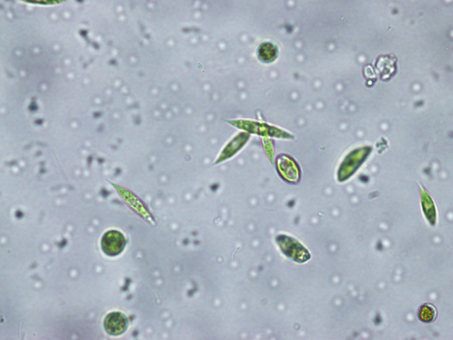 小水体,大世界--显微镜下的浮游生物,值得一看