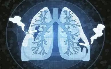 【科普】肺癌的早期发现和预防