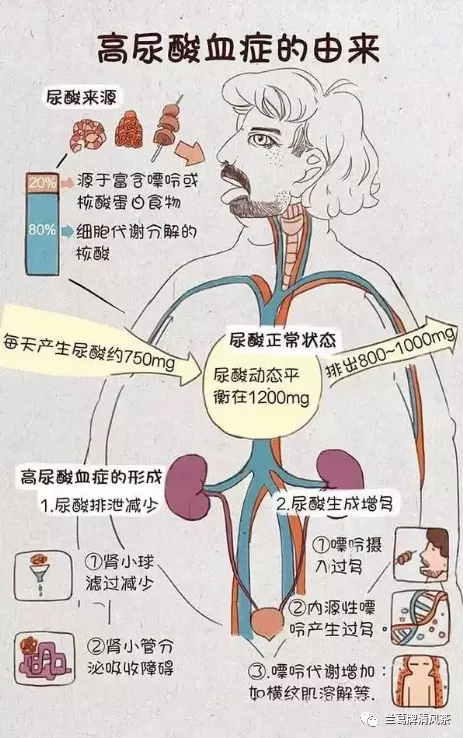 带您了解高尿酸血症-学网-中国IT综合门户网站